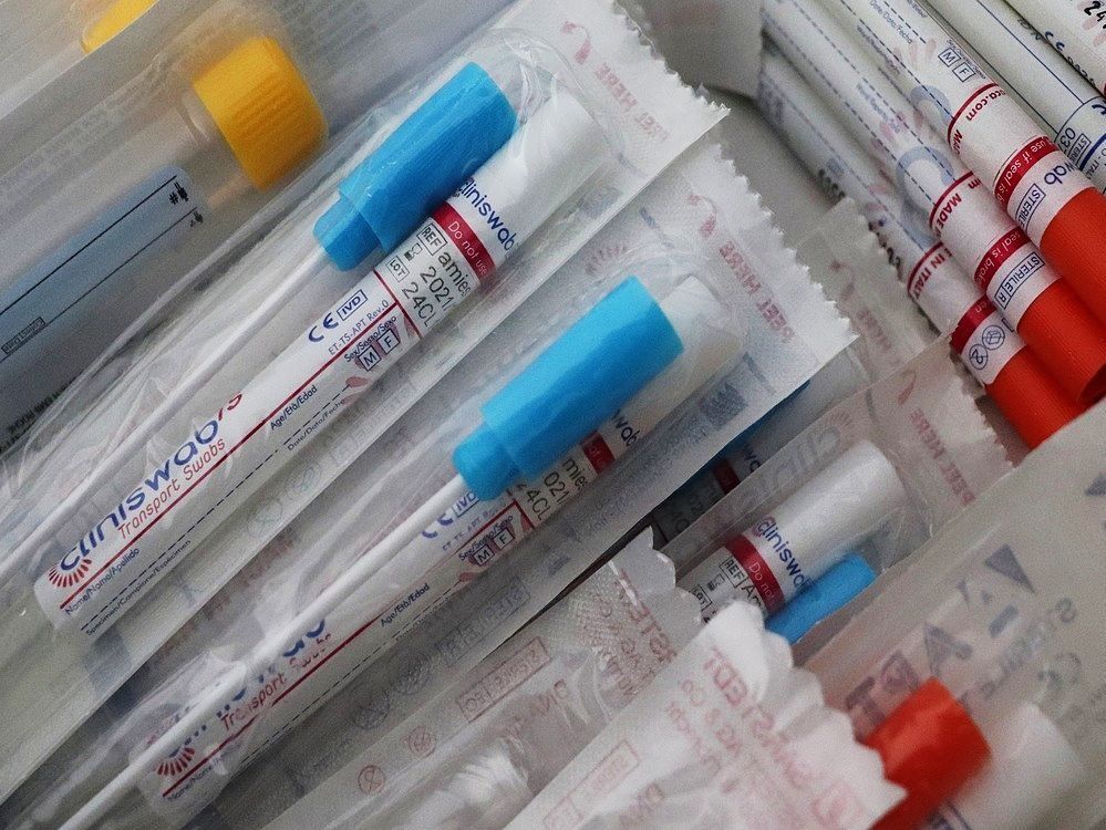 Más de 18 000 muestras para COVID-19 se perdieron por fallas en el proceso